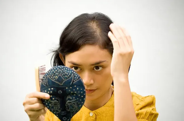 Best Hair Fall Homeopathic Medicine